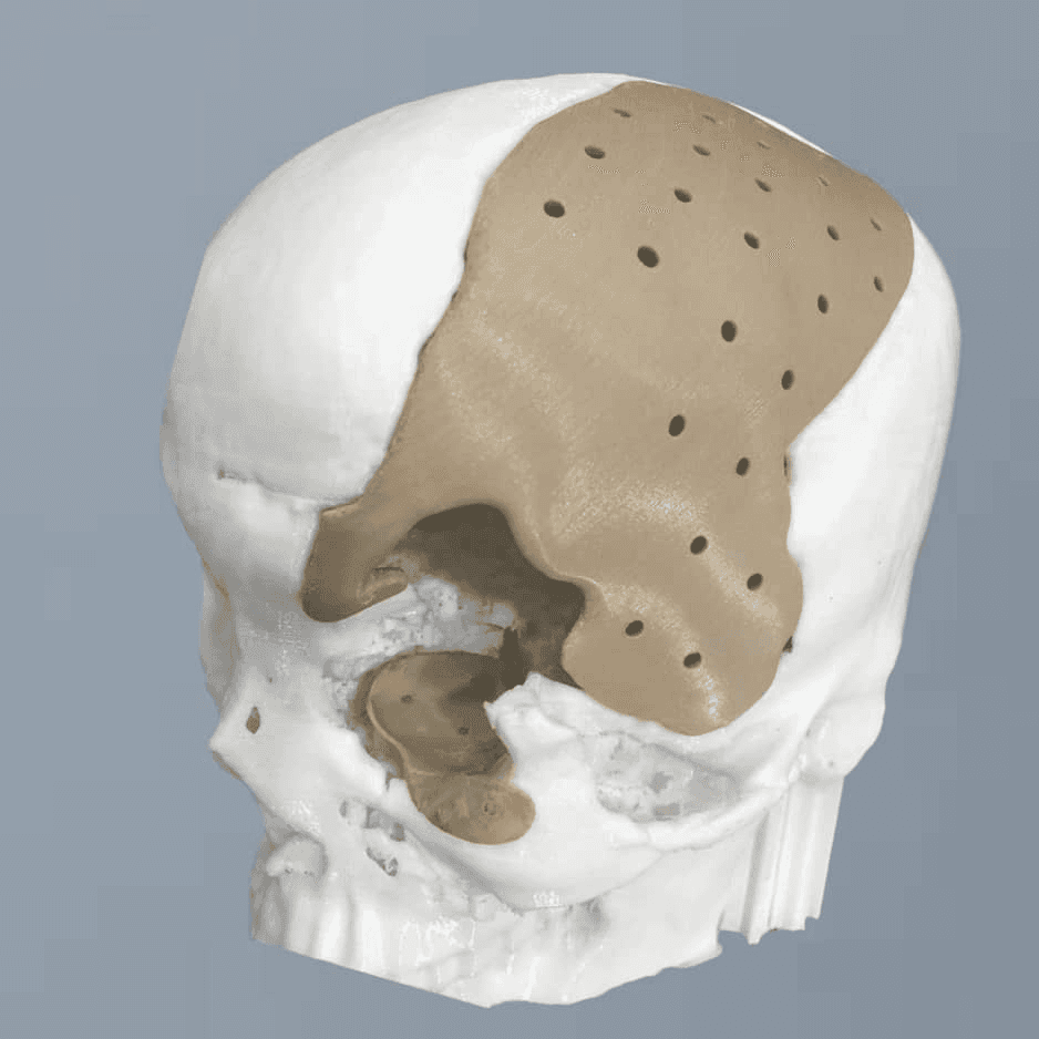 Cranionyx®